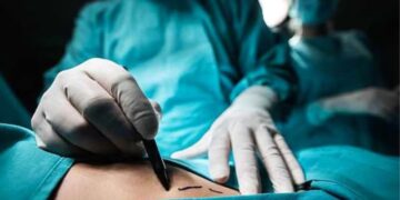 Protección a las víct1m4s: se prohíbe el uso de biopolímeros y se da cárcel para médicos que los usen