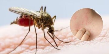 Con 174 casos entre septiembre y octubre, hay alerta por brote de dengue en Armenia