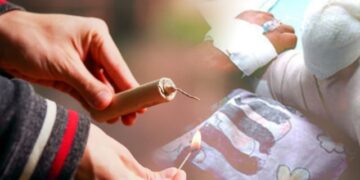 Quemados con pólvora siguen aumentando: ya son cuatro las personas afectadas en el Quindío