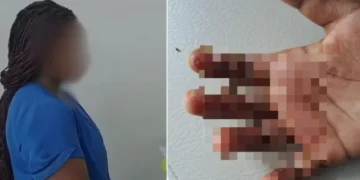 Capturan a madre que le quemó las manos a su hija de 7 años en la estufa